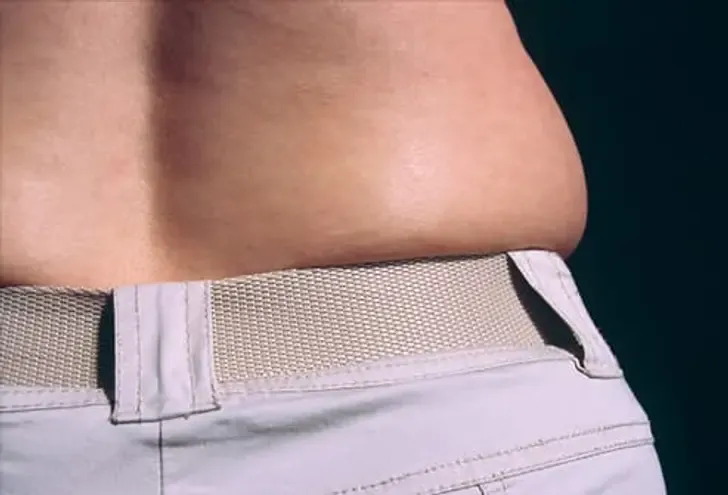 Kilo Alımının Gizli Nedenleri: Hormonlar, İlaçlar ve Diğer Faktörler