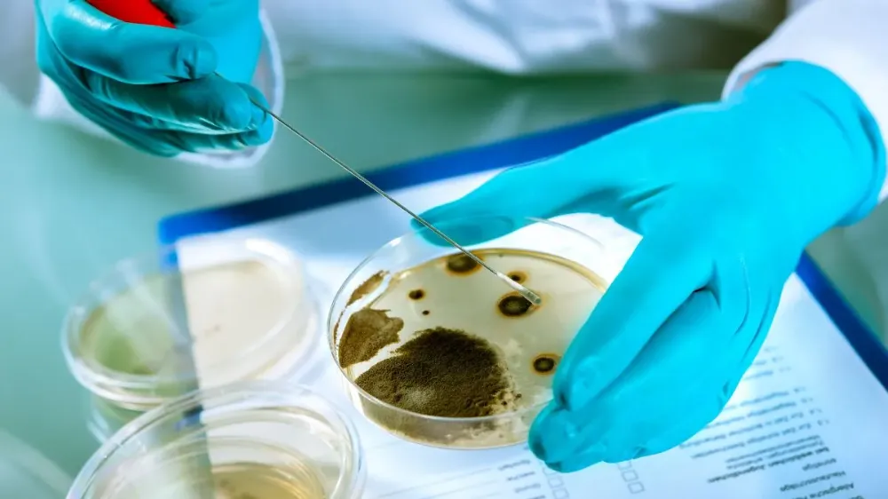 Listeria Bakterisi ve Gıda Zehirlenmesi