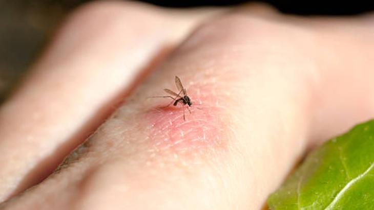 Yaz Aylarının Kabusu Sivrisinekler 5 yaz aylarinin kabusu sivrisinekler 4 qYVlIsVH