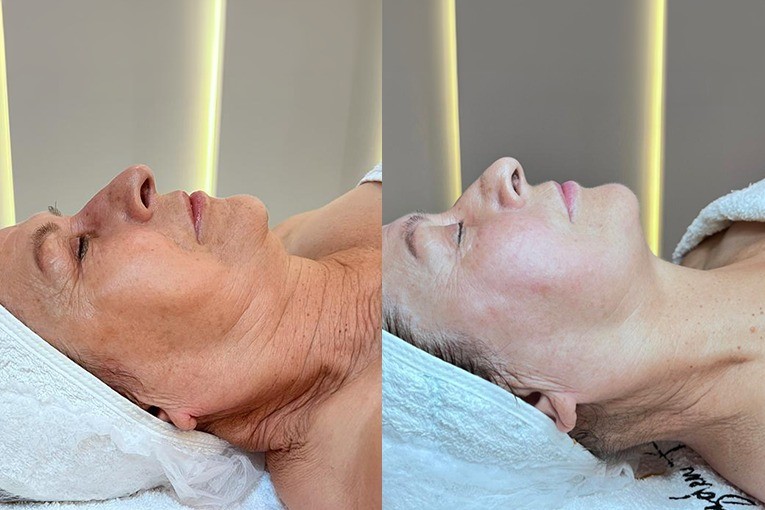 dogru cilt bakimiyla isildayin 1 L2X34FTg