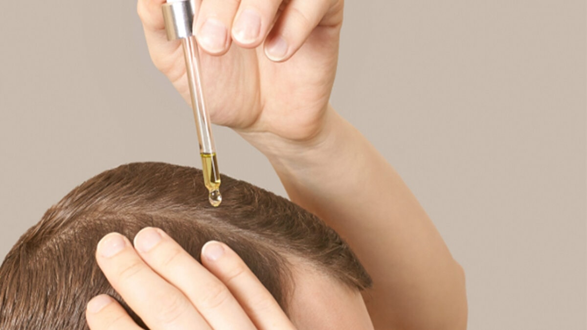 sac dokulmesine dogal cozum iste mucizevi etki yaratan 10 yag 0